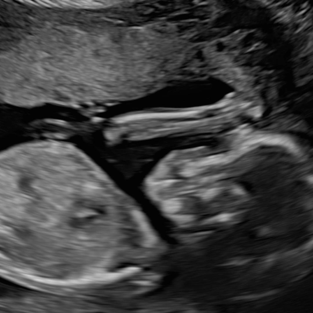 Photo shared by Erika for their Babylist baby registry.