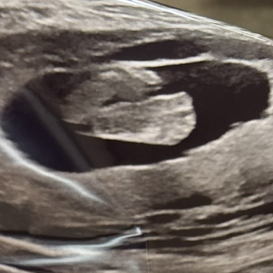 Photo shared by Mary for their Babylist baby registry.