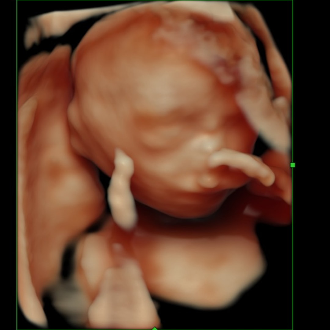 Photo shared by Narelle for their Babylist baby registry.