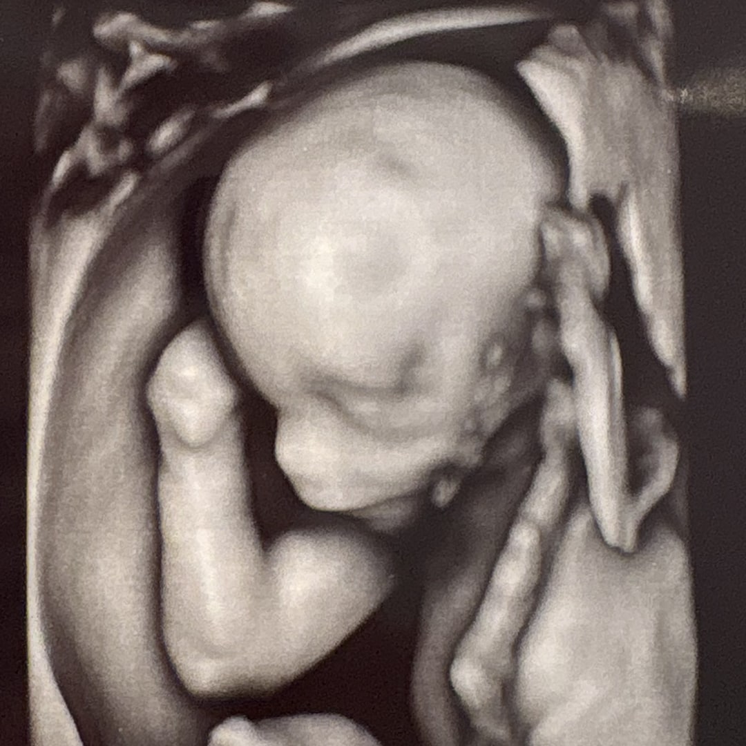 Photo shared by Adrienne for their Babylist baby registry.