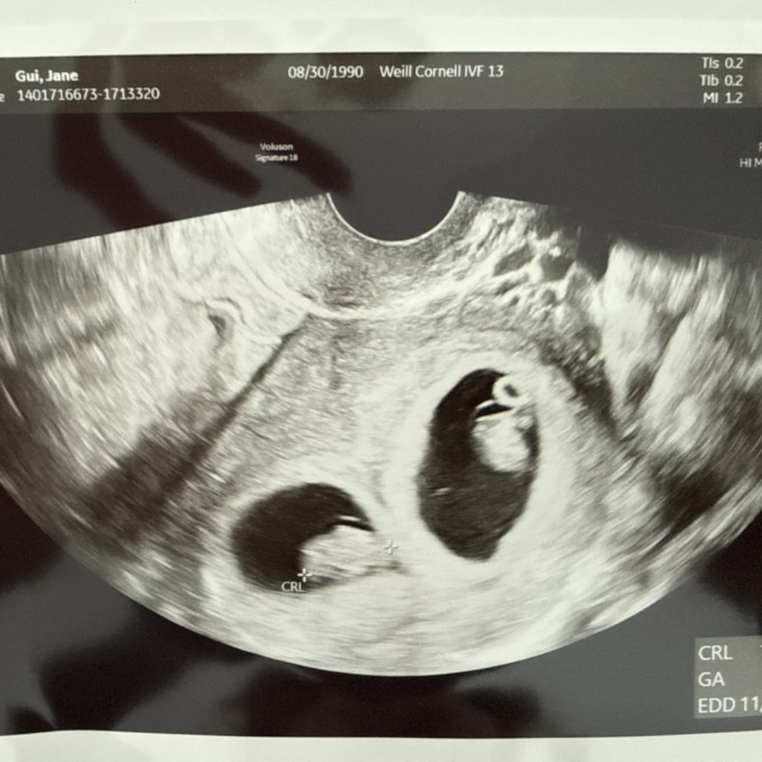 Photo shared by Jane for their Babylist baby registry.