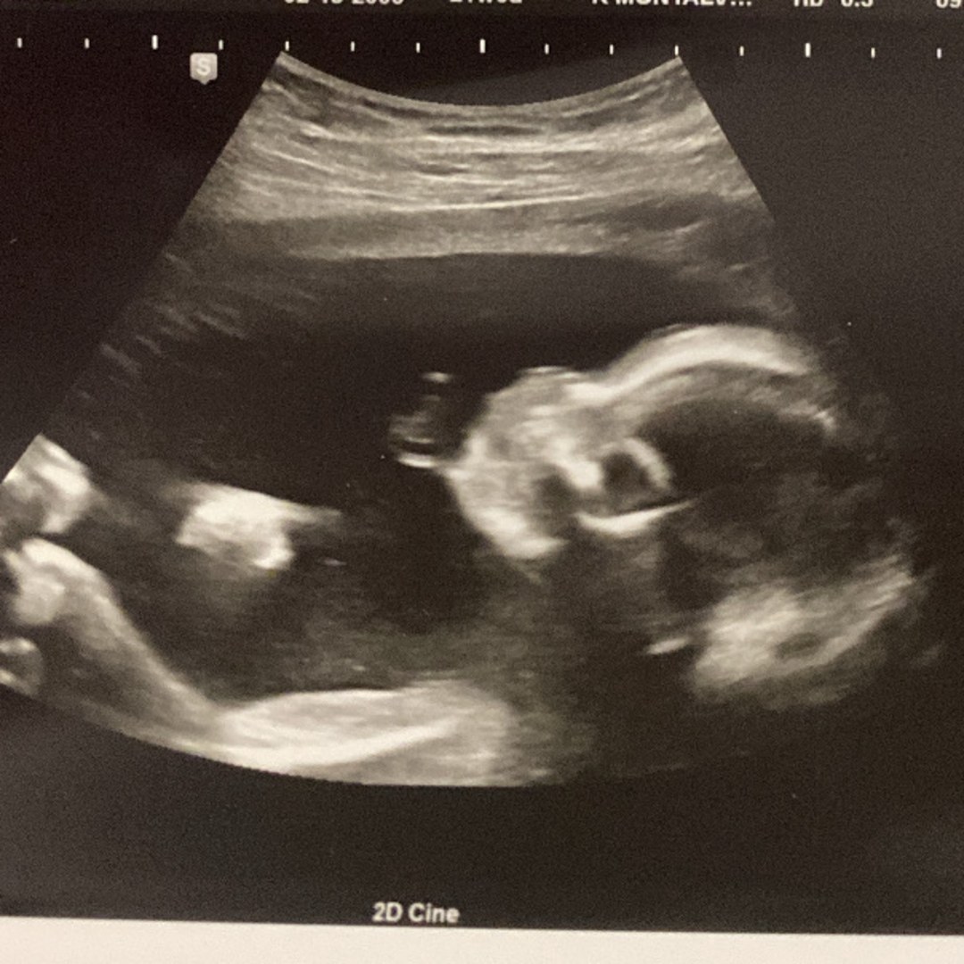 Photo shared by Desiree for their Babylist baby registry.