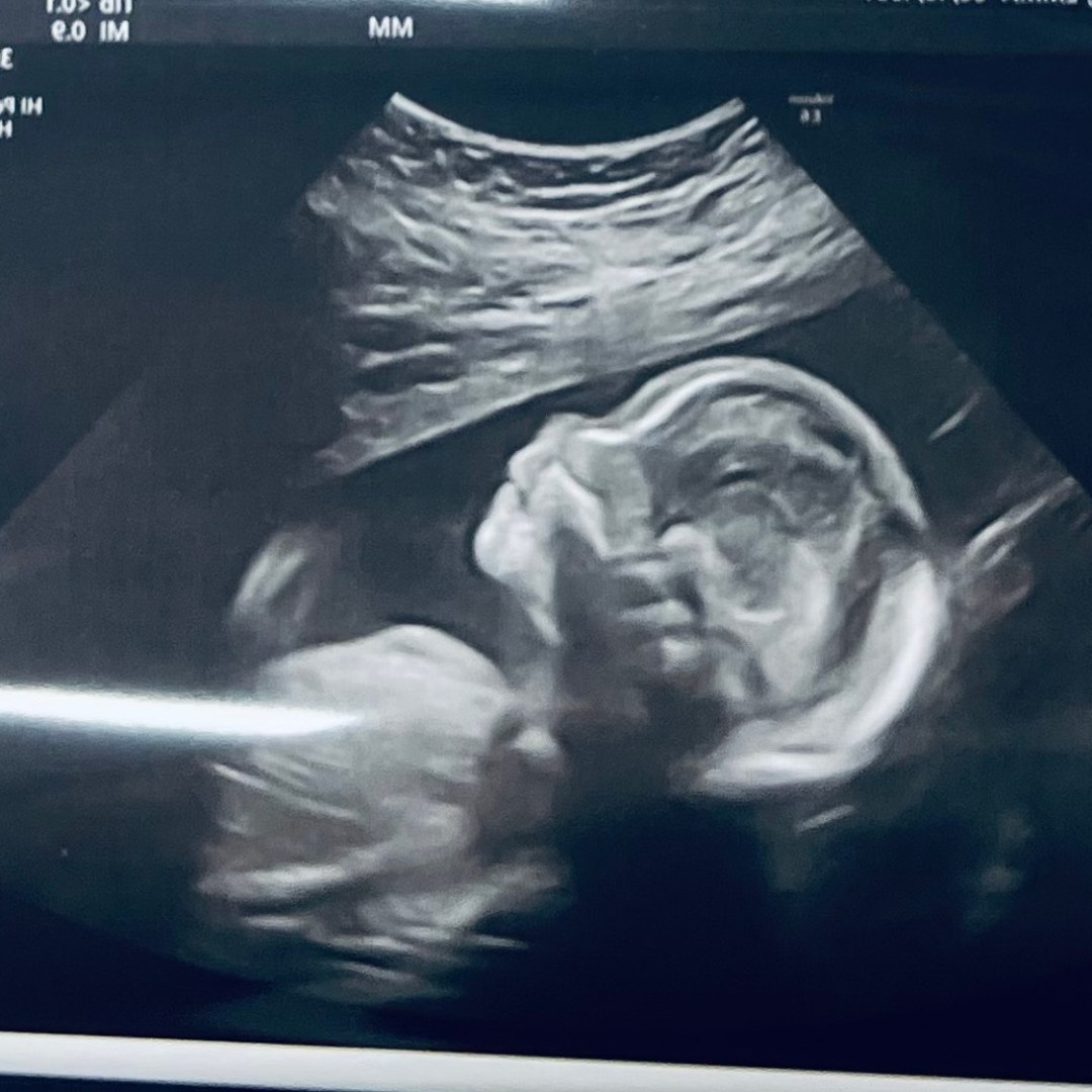 Photo shared by Emma for their Babylist baby registry.
