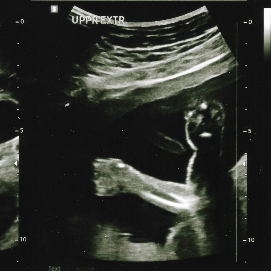 Photo shared by Eve for their Babylist baby registry.