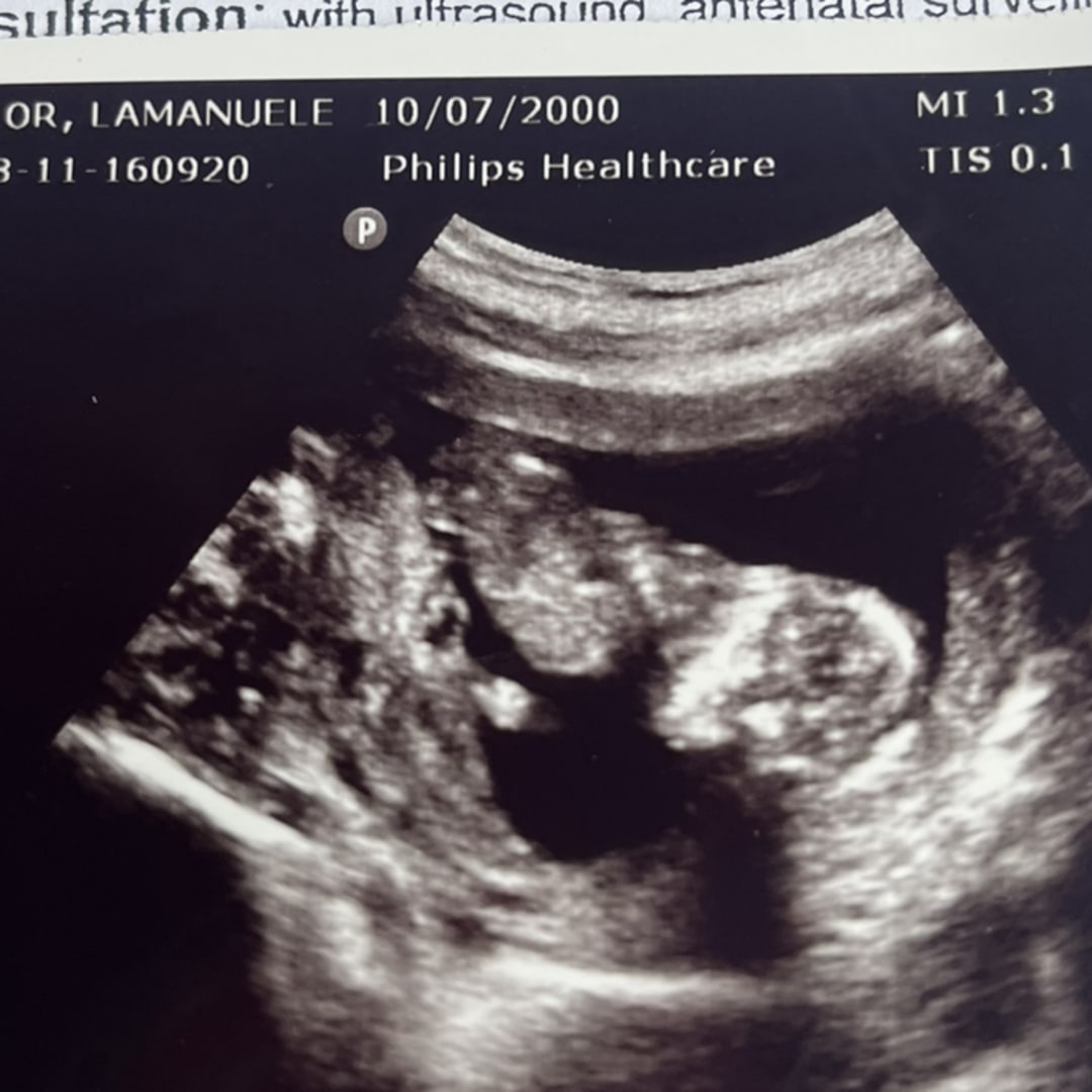 Photo shared by LaManuele for their Babylist baby registry.