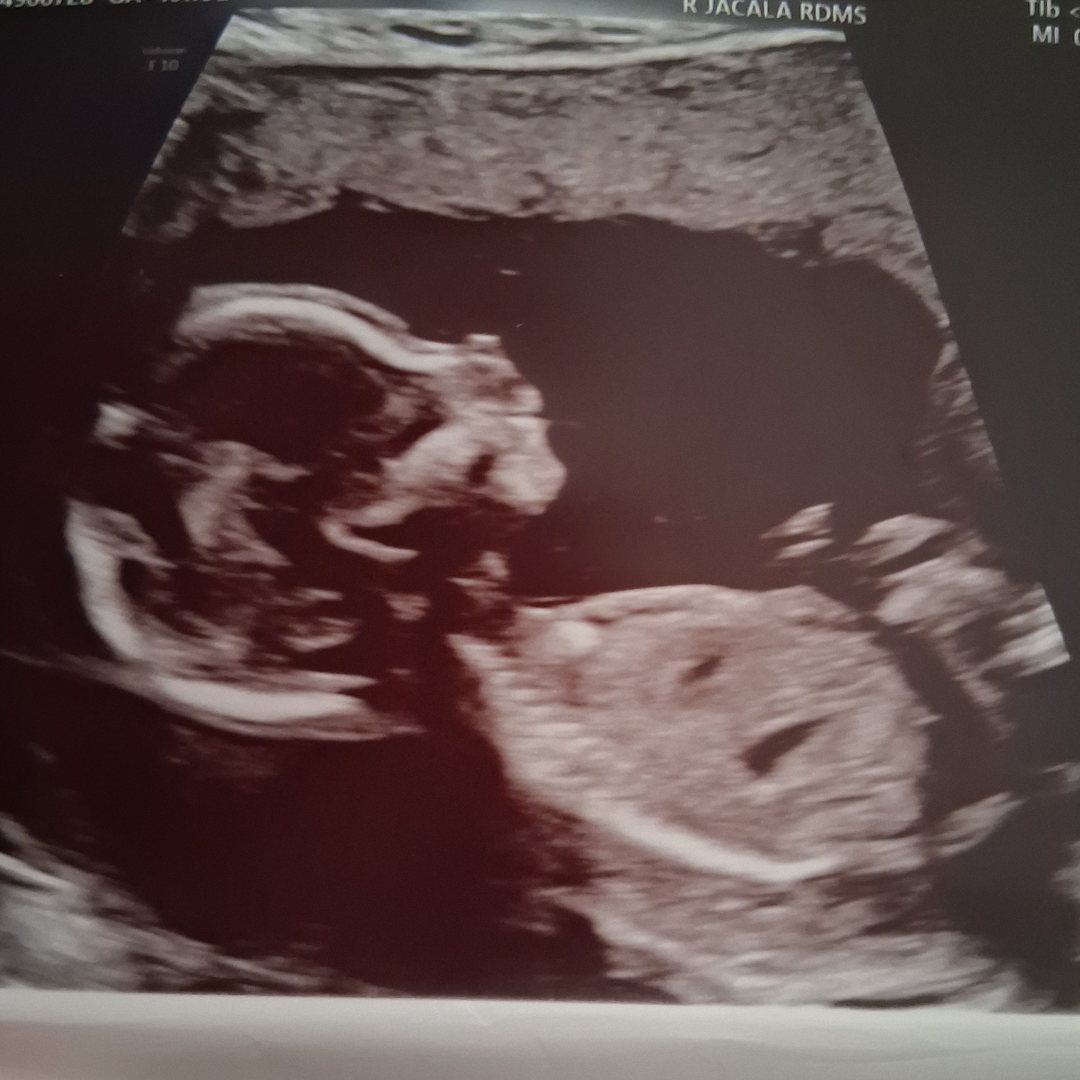 Photo shared by Shela for their Babylist baby registry.