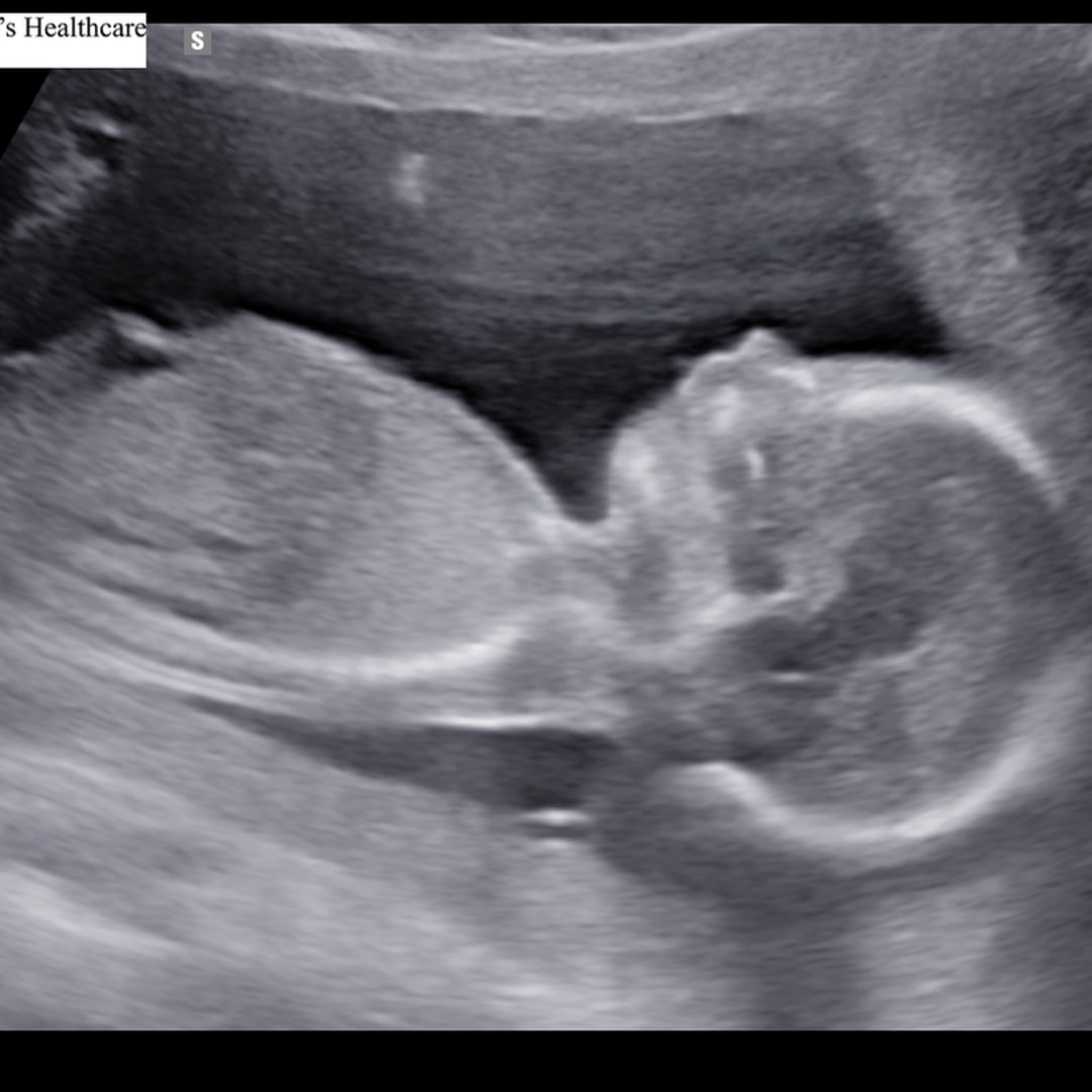 Photo shared by Marissa for their Babylist baby registry.