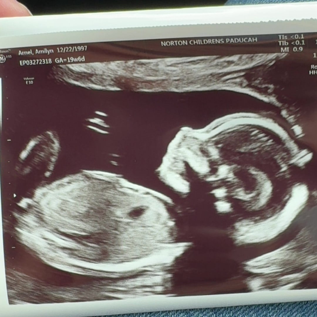 Photo shared by Amilyn for their Babylist baby registry.