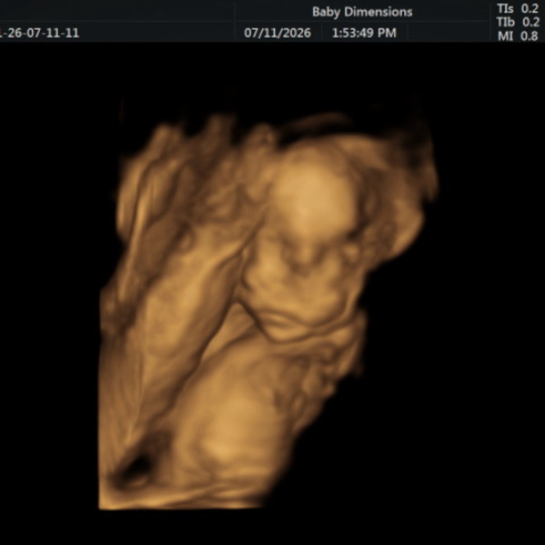 Photo shared by Anna for their Babylist baby registry.