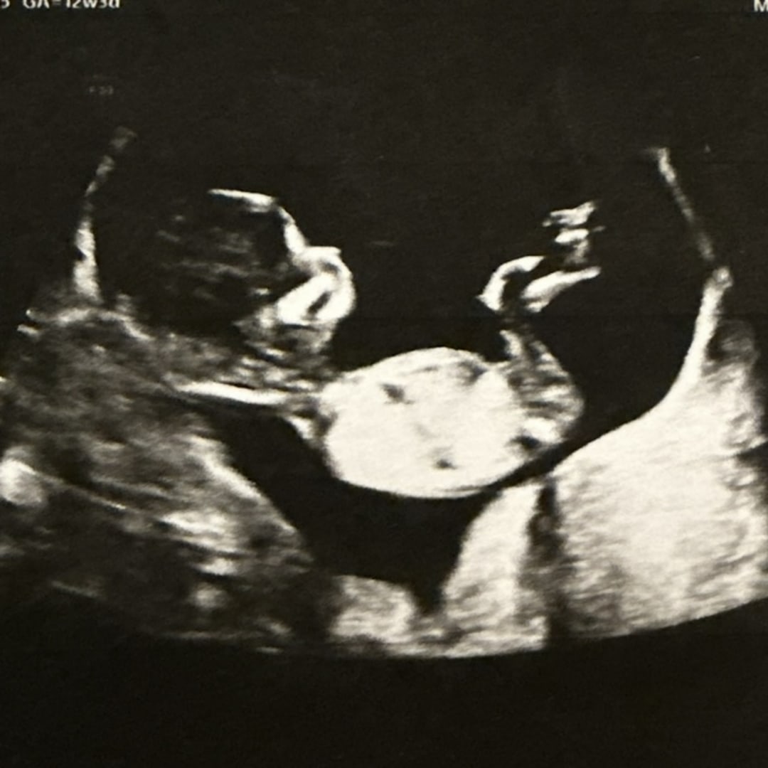 Photo shared by Taylor for their Babylist baby registry.