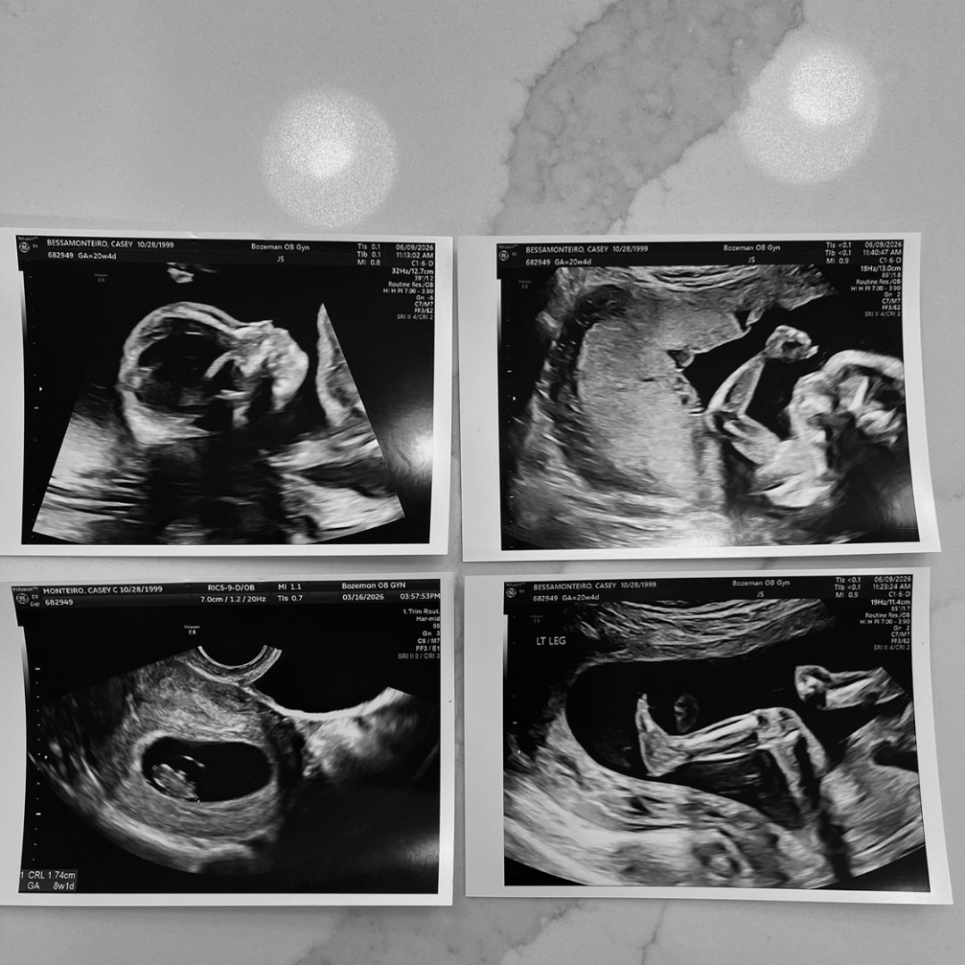 Photo shared by Casey for their Babylist baby registry.