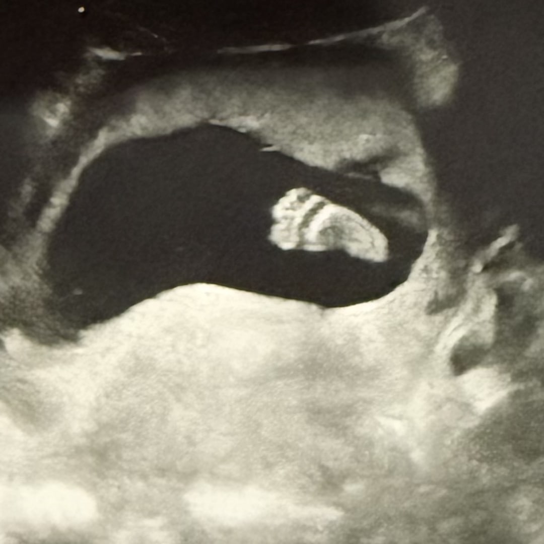 Photo shared by Kimberly for their Babylist baby registry.