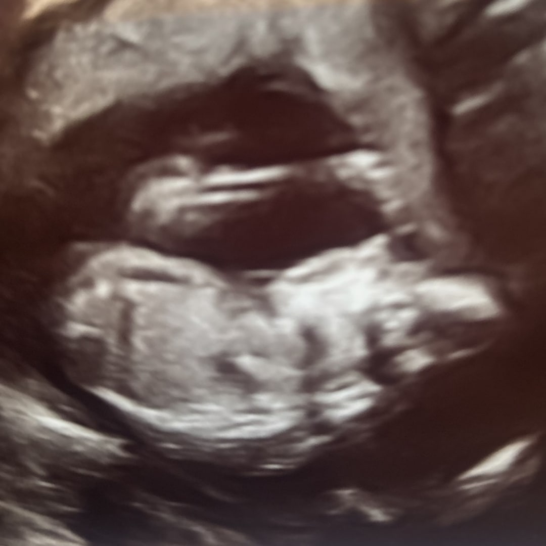 Photo shared by Isabella for their Babylist baby registry.
