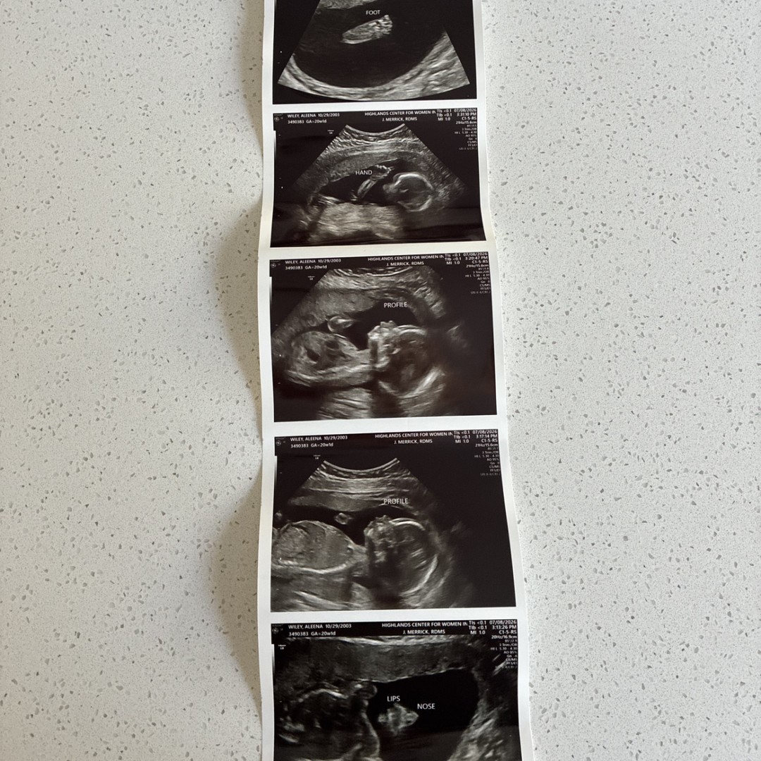 Photo shared by Aleena for their Babylist baby registry.