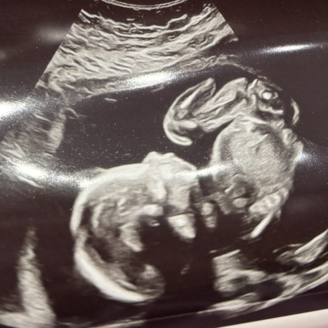 Photo shared by Anne for their Babylist baby registry.