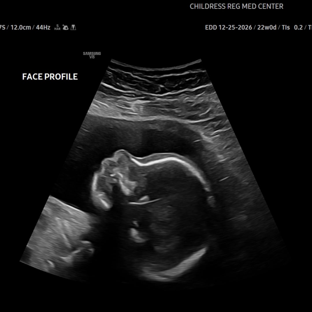 Photo shared by Kyler for their Babylist baby registry.