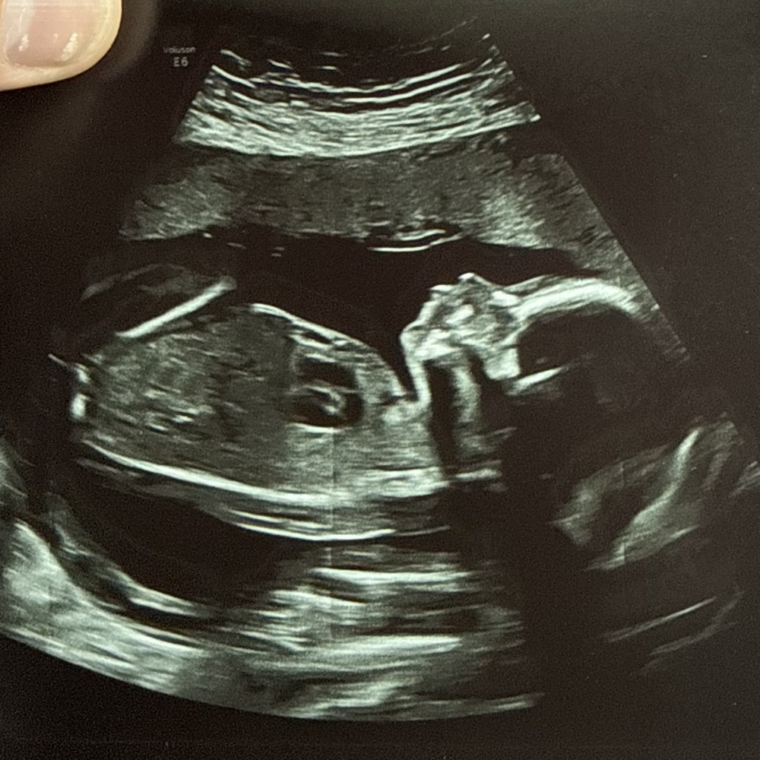 Photo shared by Anna for their Babylist baby registry.