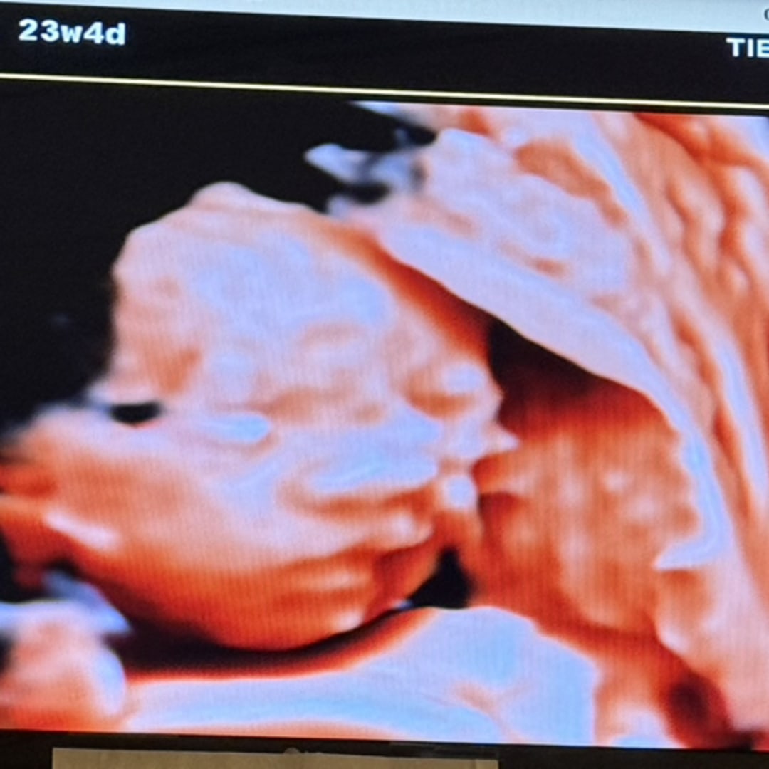 Photo shared by Victoria for their Babylist baby registry.