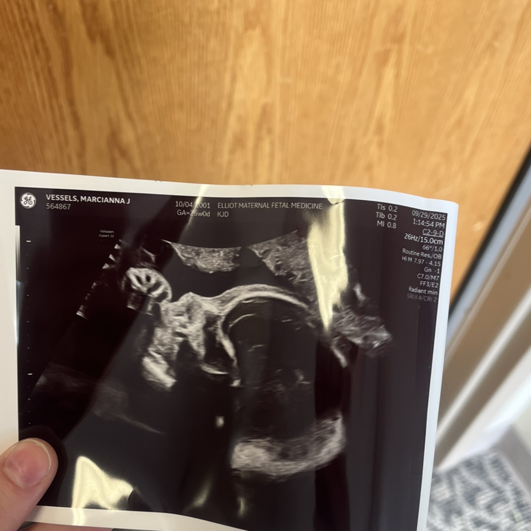 Photo shared by Marcianna for their Babylist baby registry.