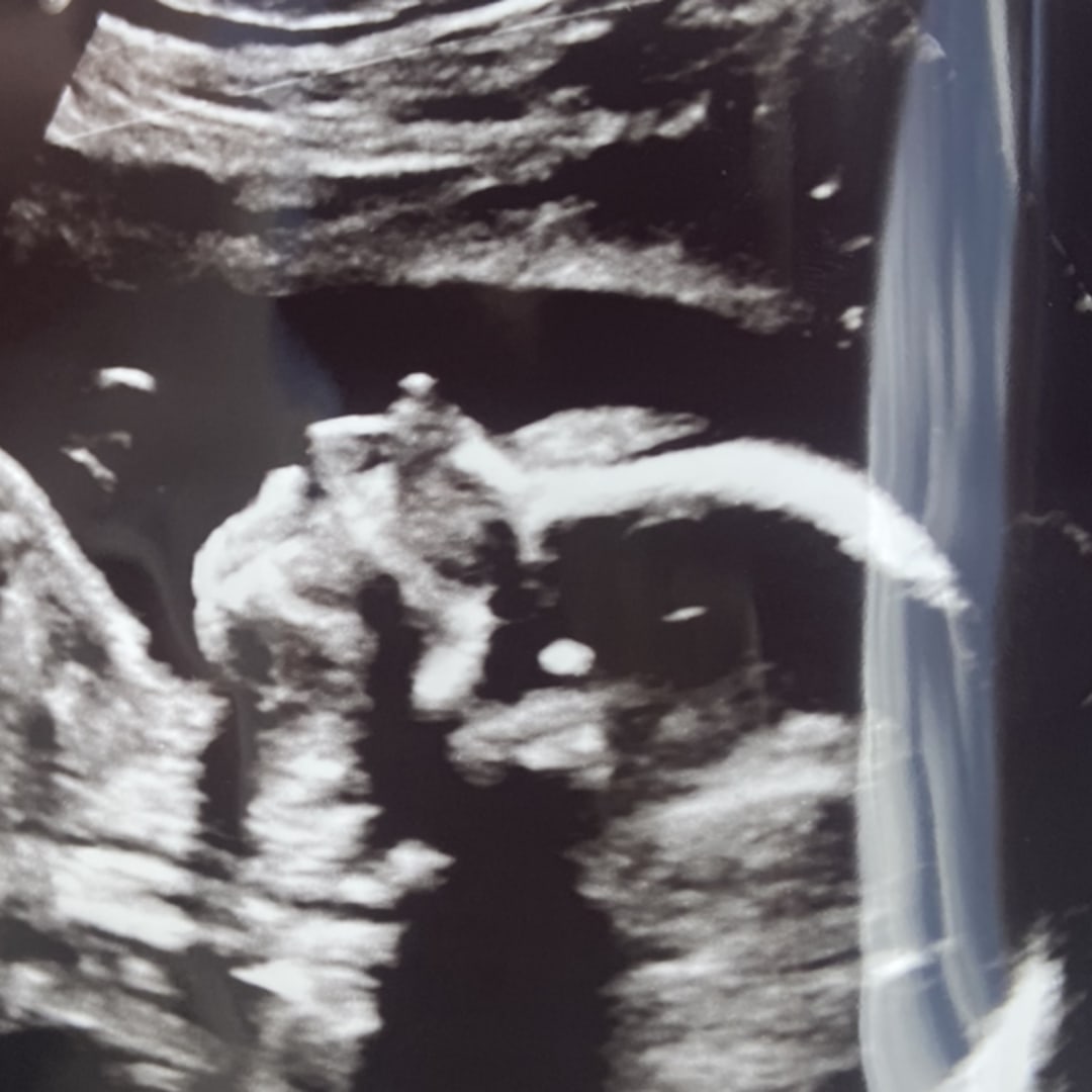 Photo shared by Sarah & Phillip for their Babylist baby registry.