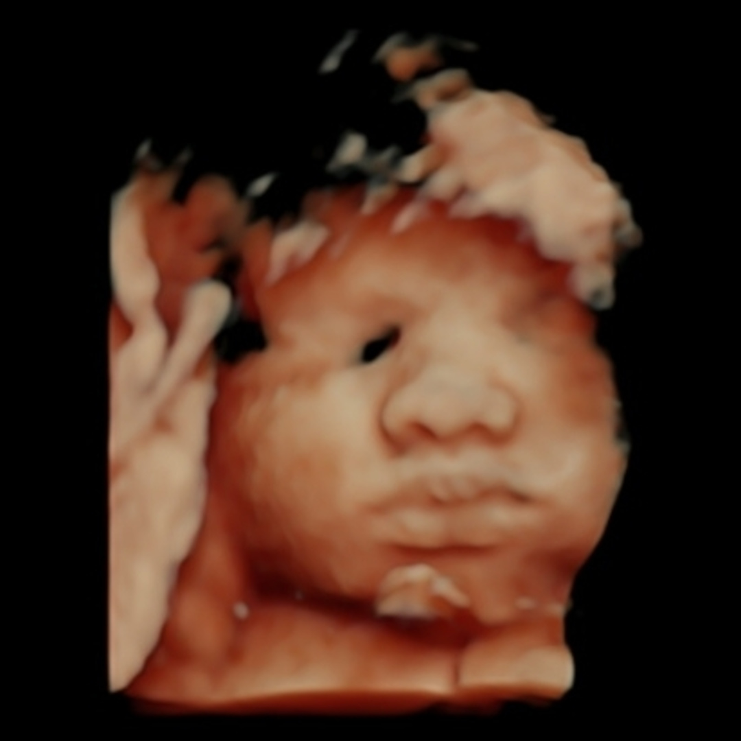 Photo shared by Amara for their Babylist baby registry.