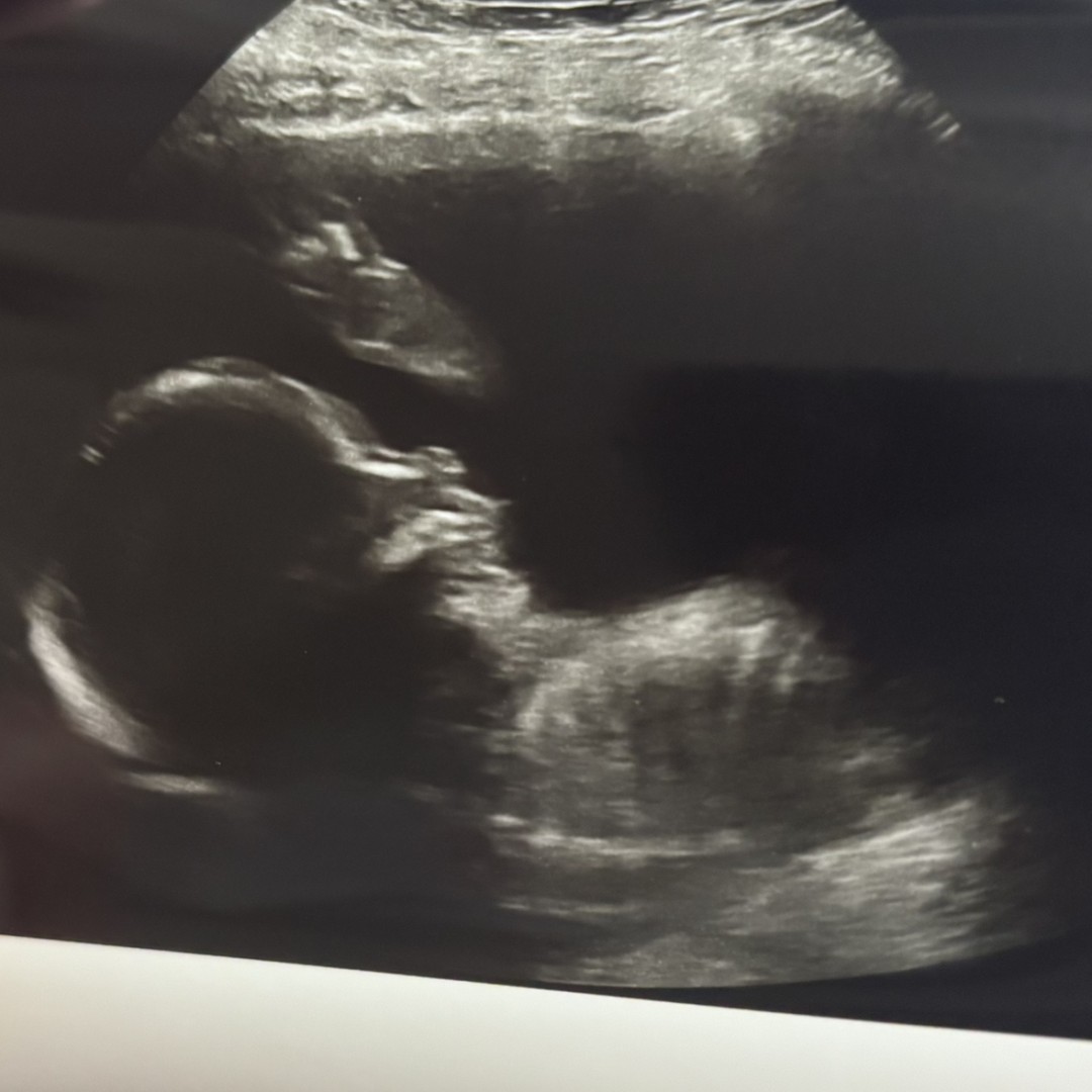 Photo shared by Brittany for their Babylist baby registry.