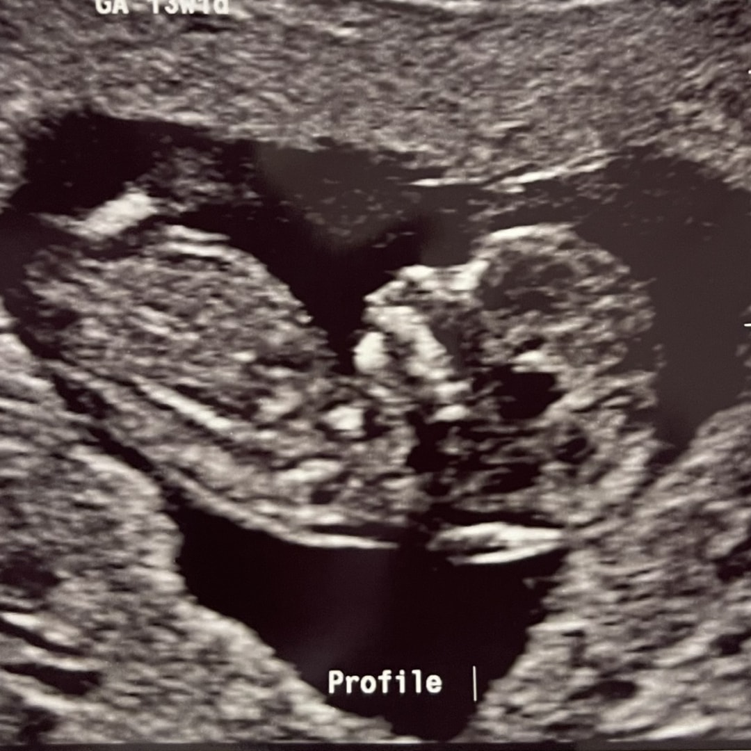 Photo shared by Emily for their Babylist baby registry.