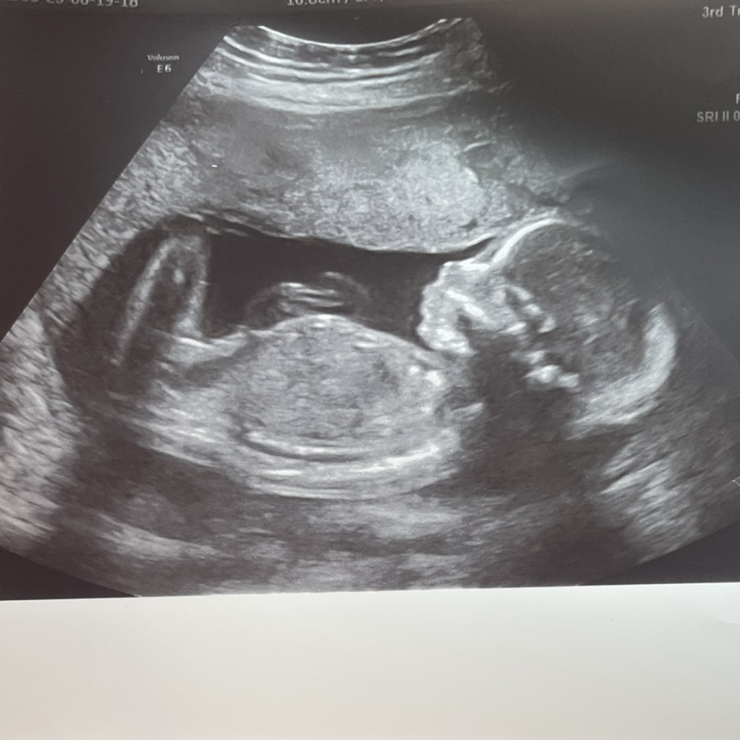 Photo shared by Susan for their Babylist baby registry.