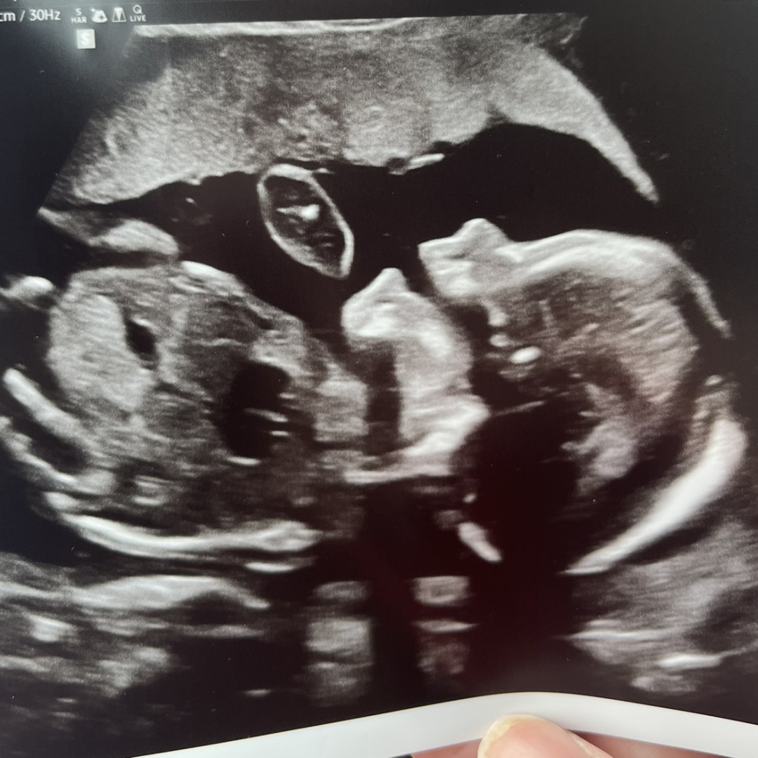 Photo shared by Nicole for their Babylist baby registry.