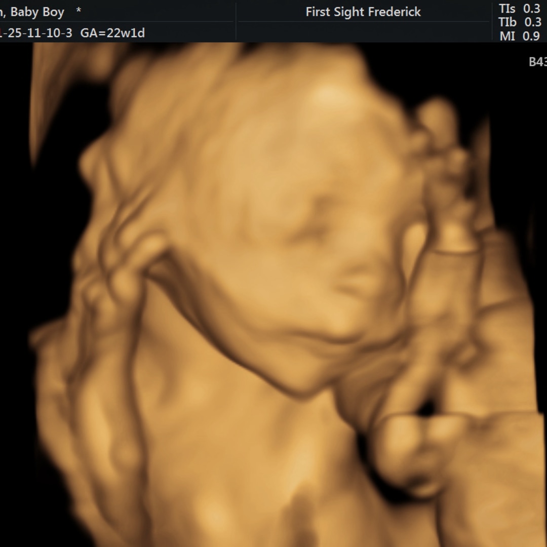 Photo shared by Lisa for their Babylist baby registry.