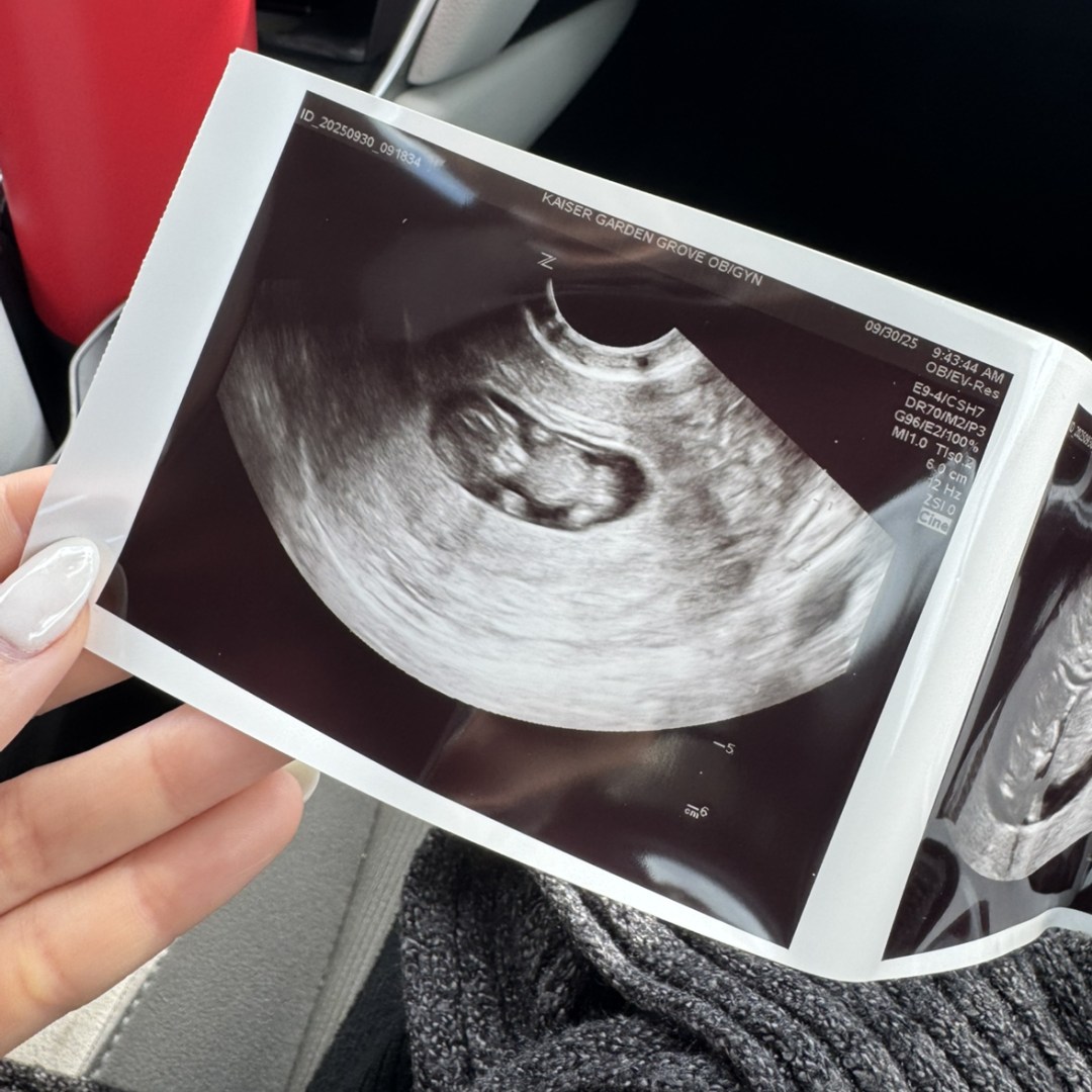 Photo shared by Alex & BT for their Babylist baby registry.