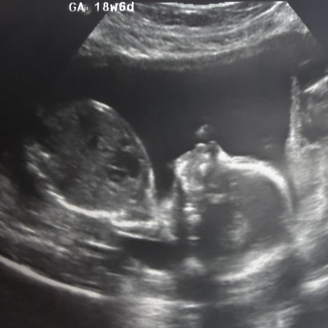 Photo shared by Patricia for their Babylist baby registry.