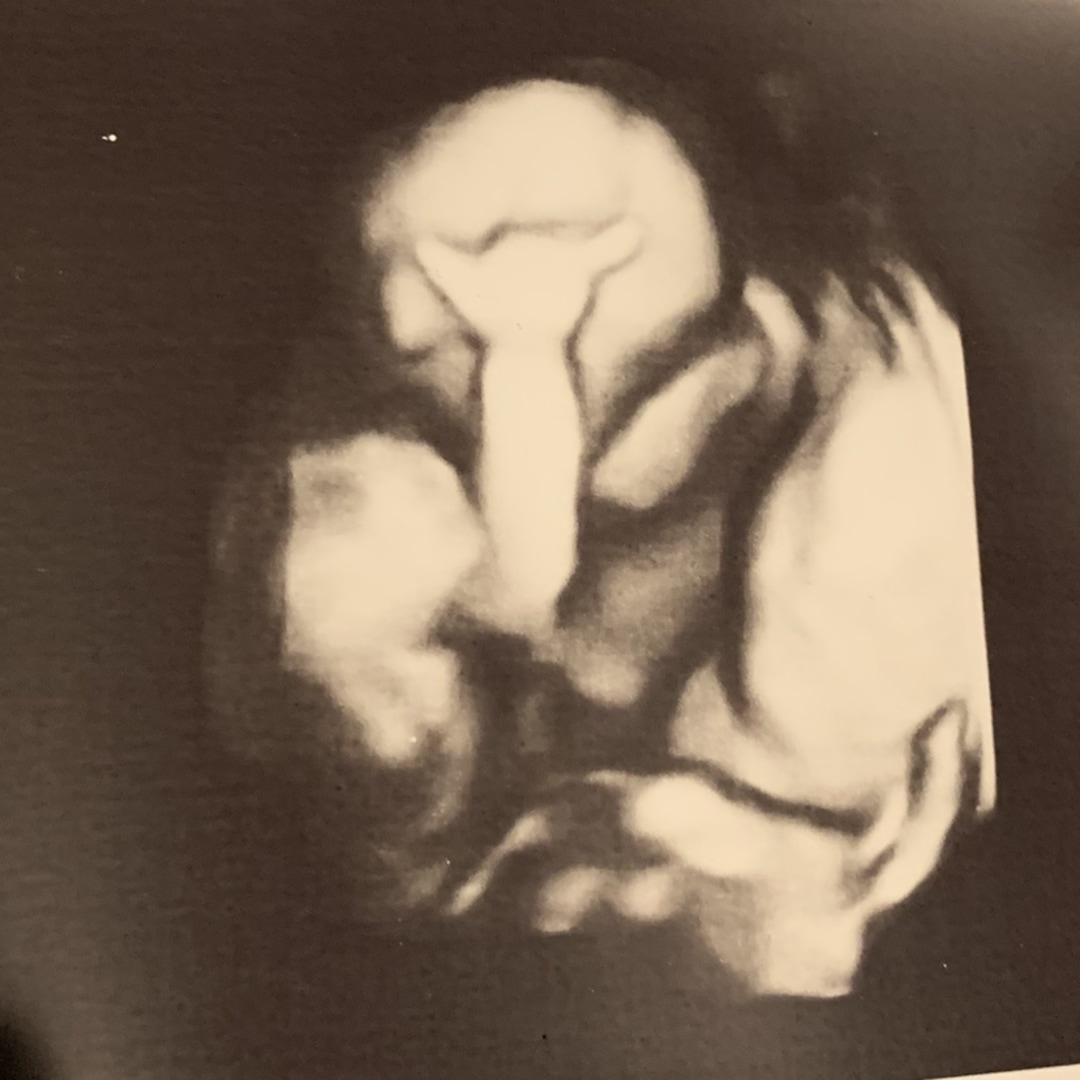 Photo shared by Alyssa for their Babylist baby registry.