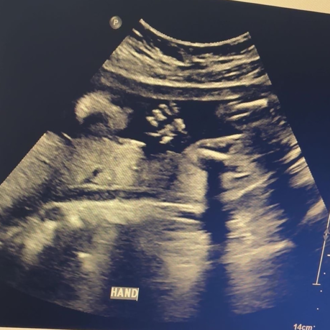 Photo shared by Caroline for their Babylist baby registry.