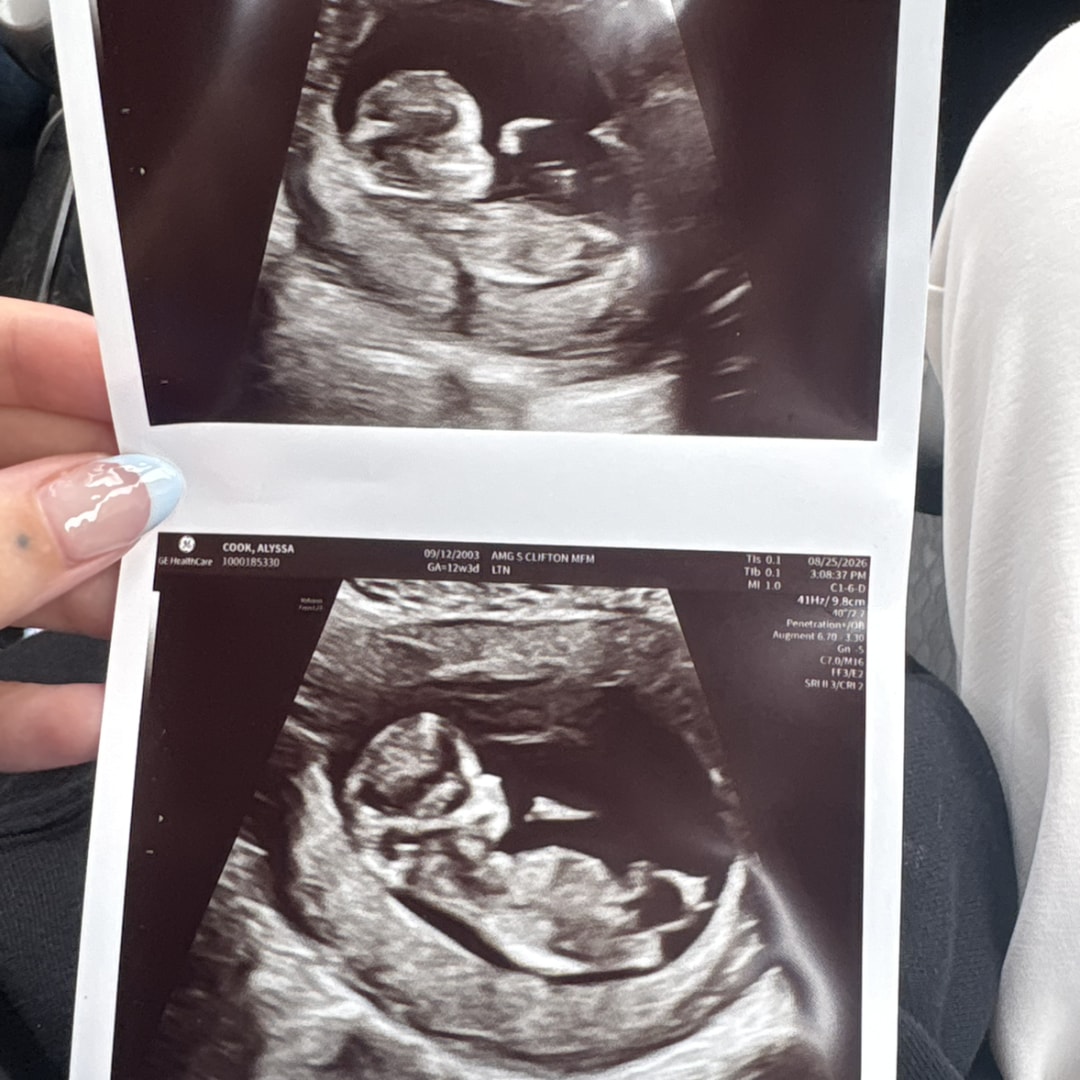 Photo shared by Alyssa for their Babylist baby registry.