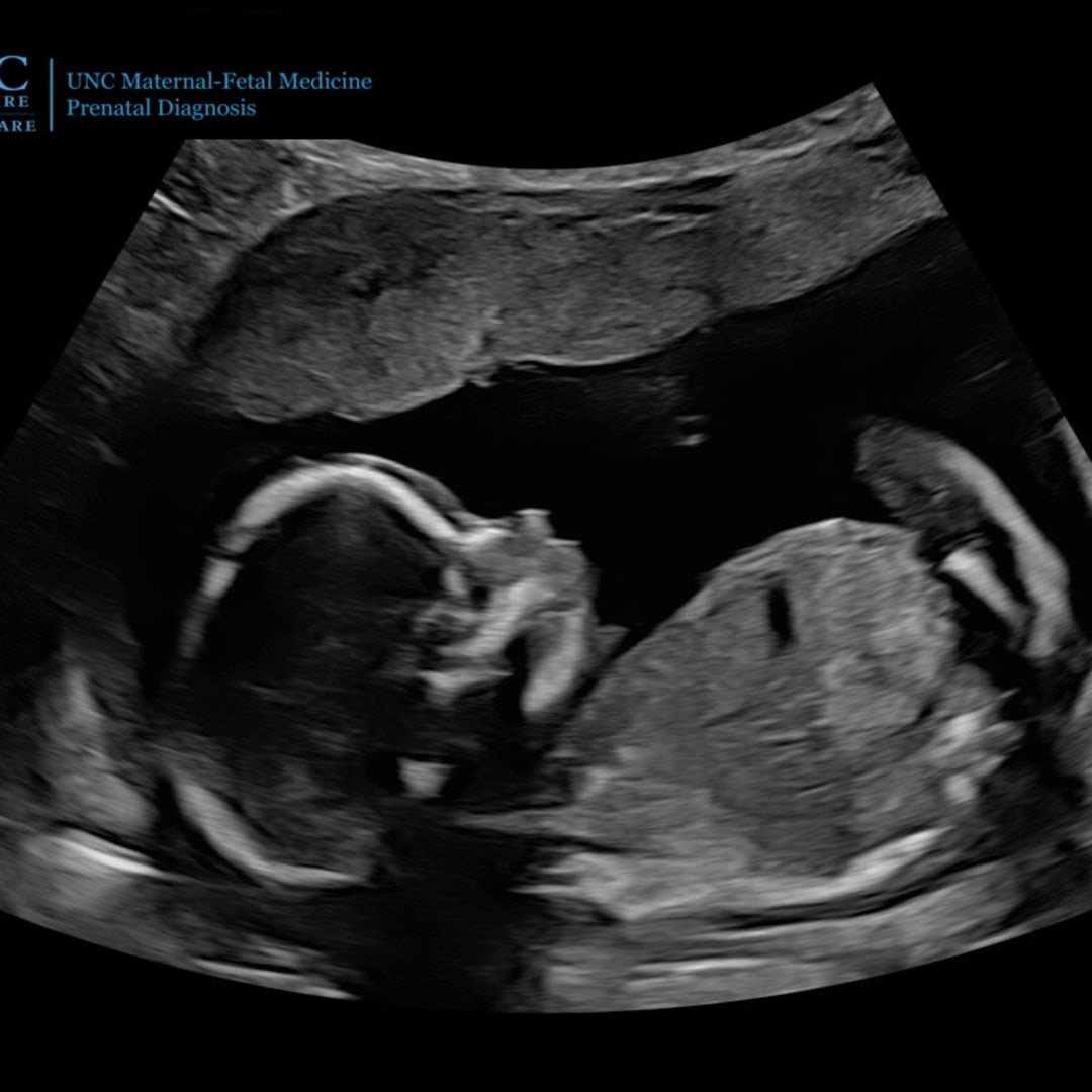 Photo shared by Rebecca for their Babylist baby registry.