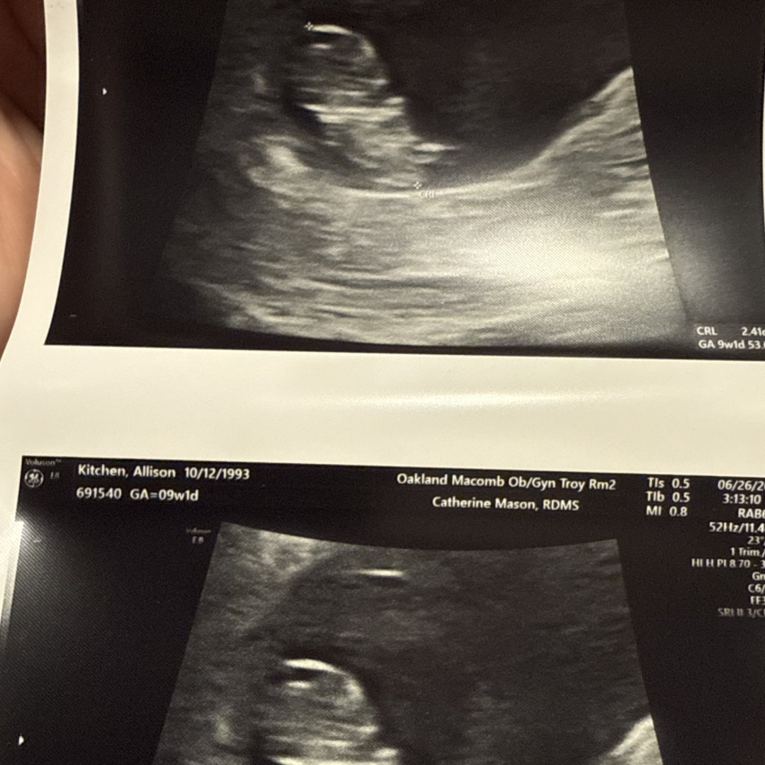 Photo shared by Allison for their Babylist baby registry.