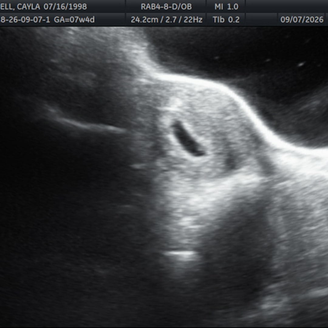 Photo shared by Cayla for their Babylist baby registry.