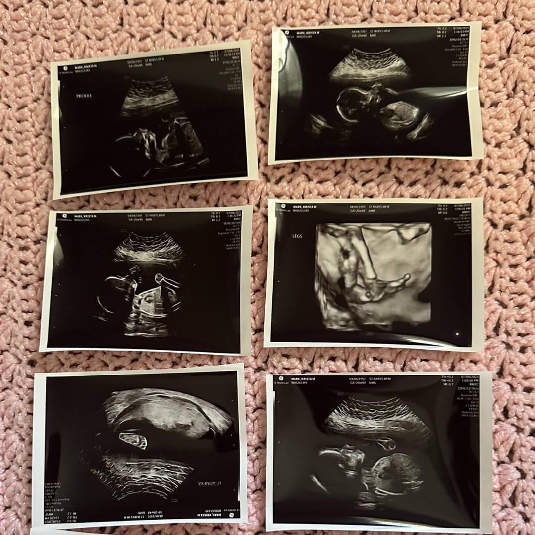 Photo shared by Krista for their Babylist baby registry.