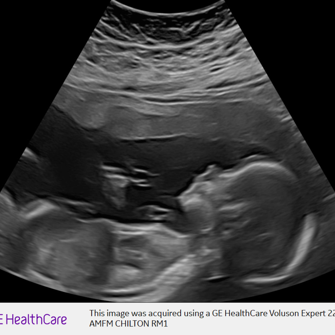 Photo shared by Alyssa for their Babylist baby registry.