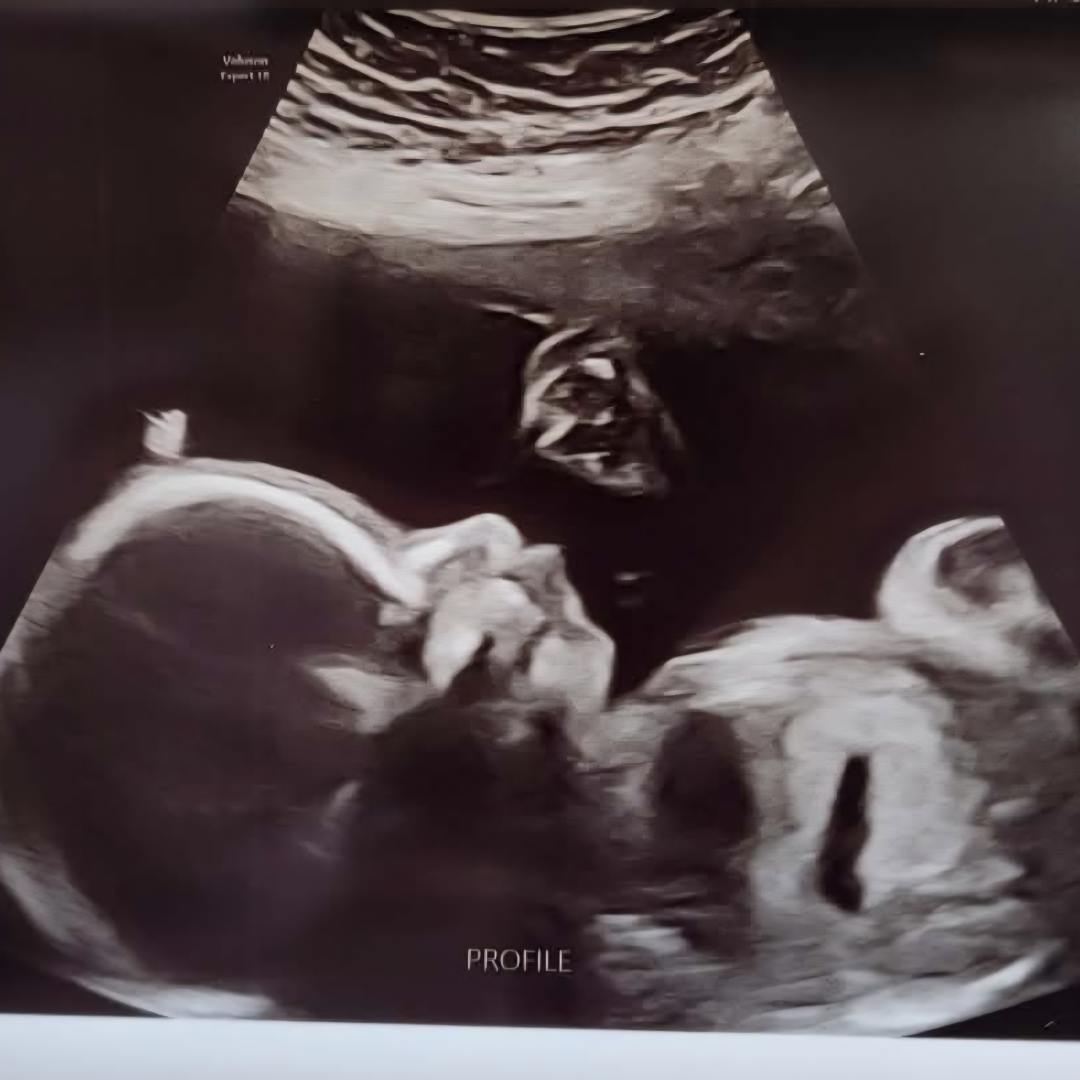 Photo shared by Elspeth for their Babylist baby registry.
