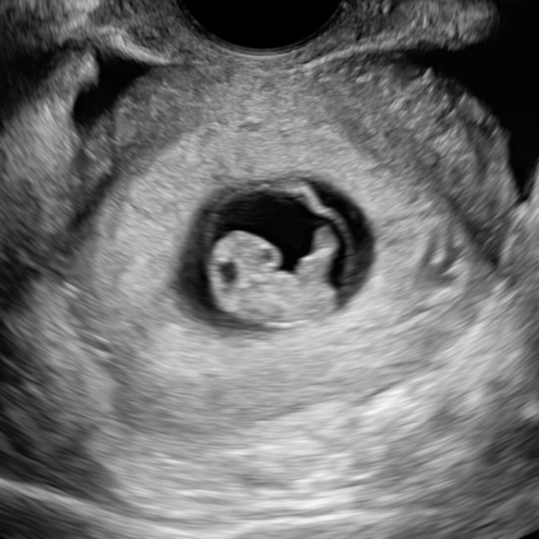 Photo shared by Alise for their Babylist baby registry.