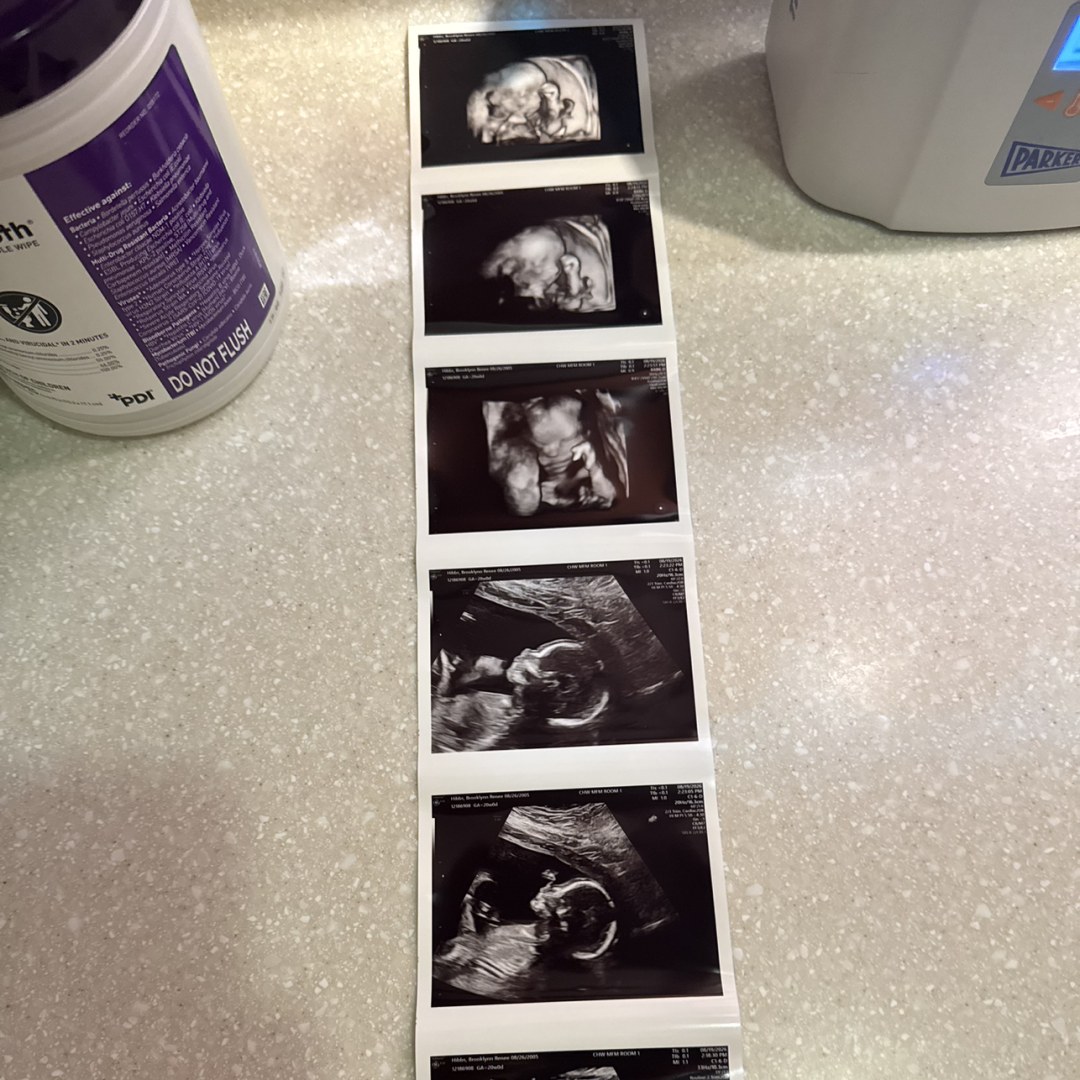 Photo shared by Brooklynn for their Babylist baby registry.