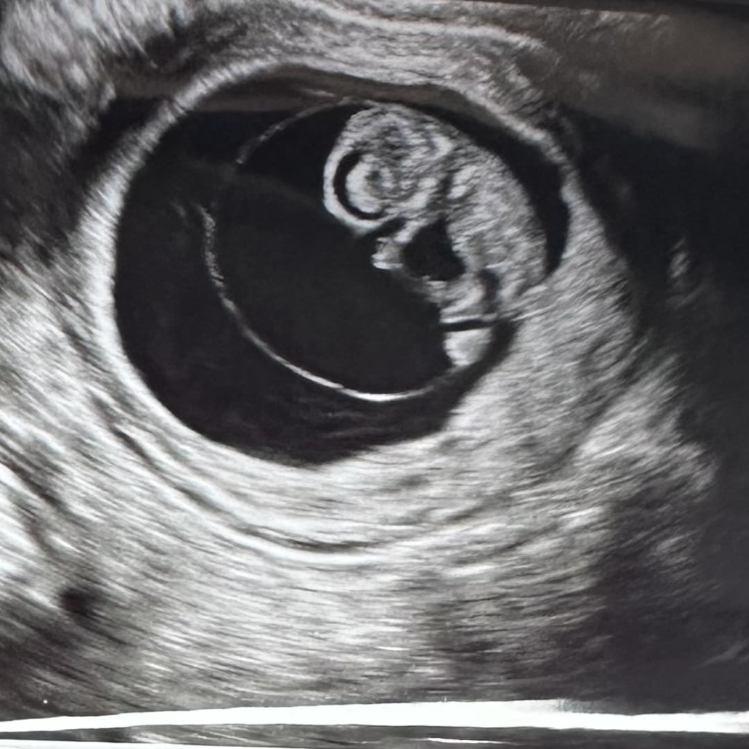 Photo shared by Alexis for their Babylist baby registry.