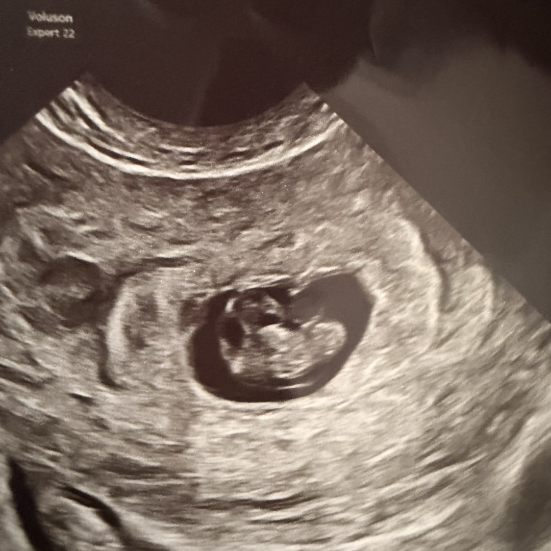 Photo shared by Claire for their Babylist baby registry.