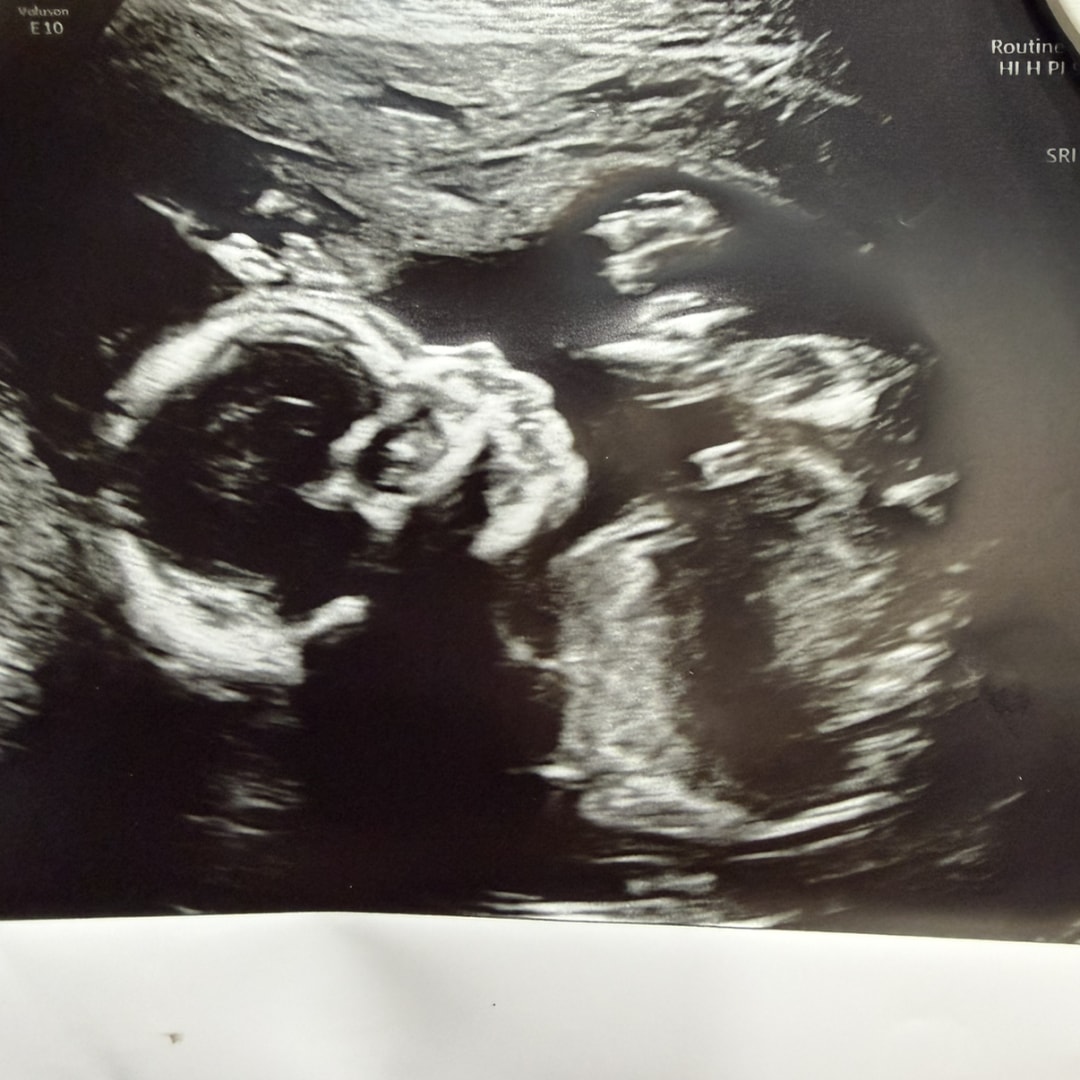 Photo shared by Bianca for their Babylist baby registry.