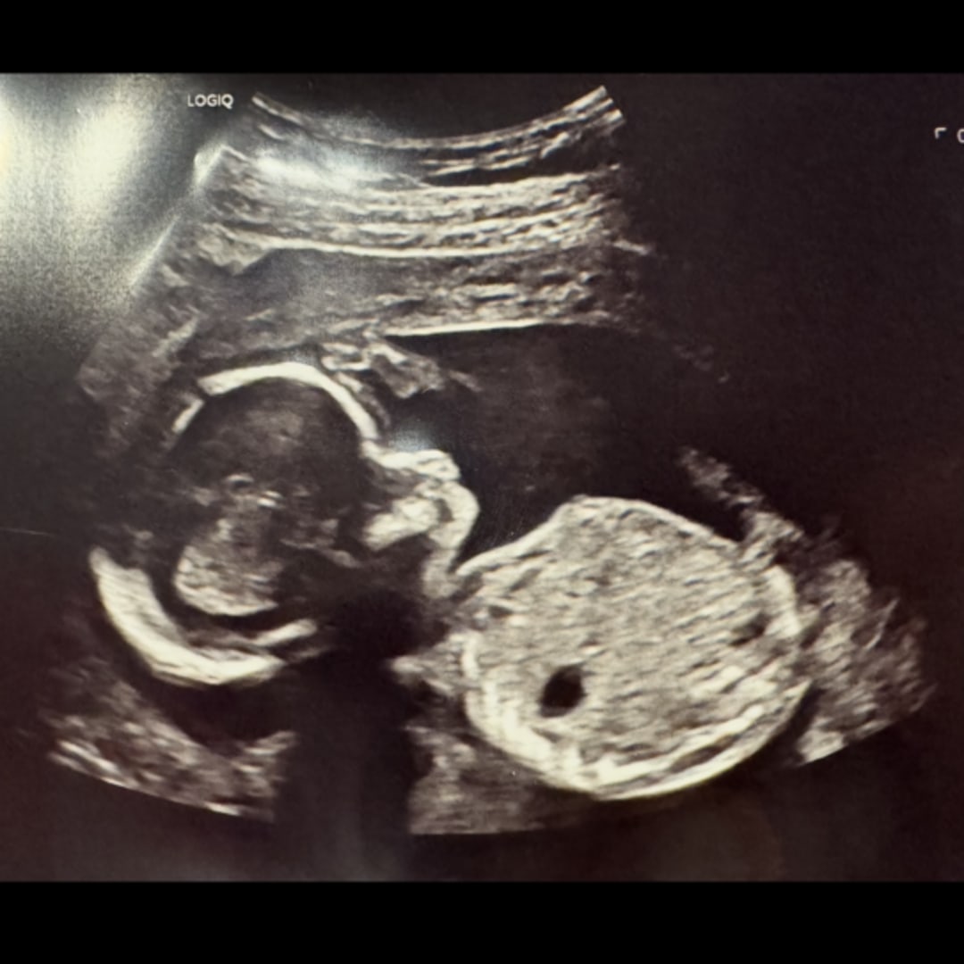 Photo shared by Alyssa for their Babylist baby registry.