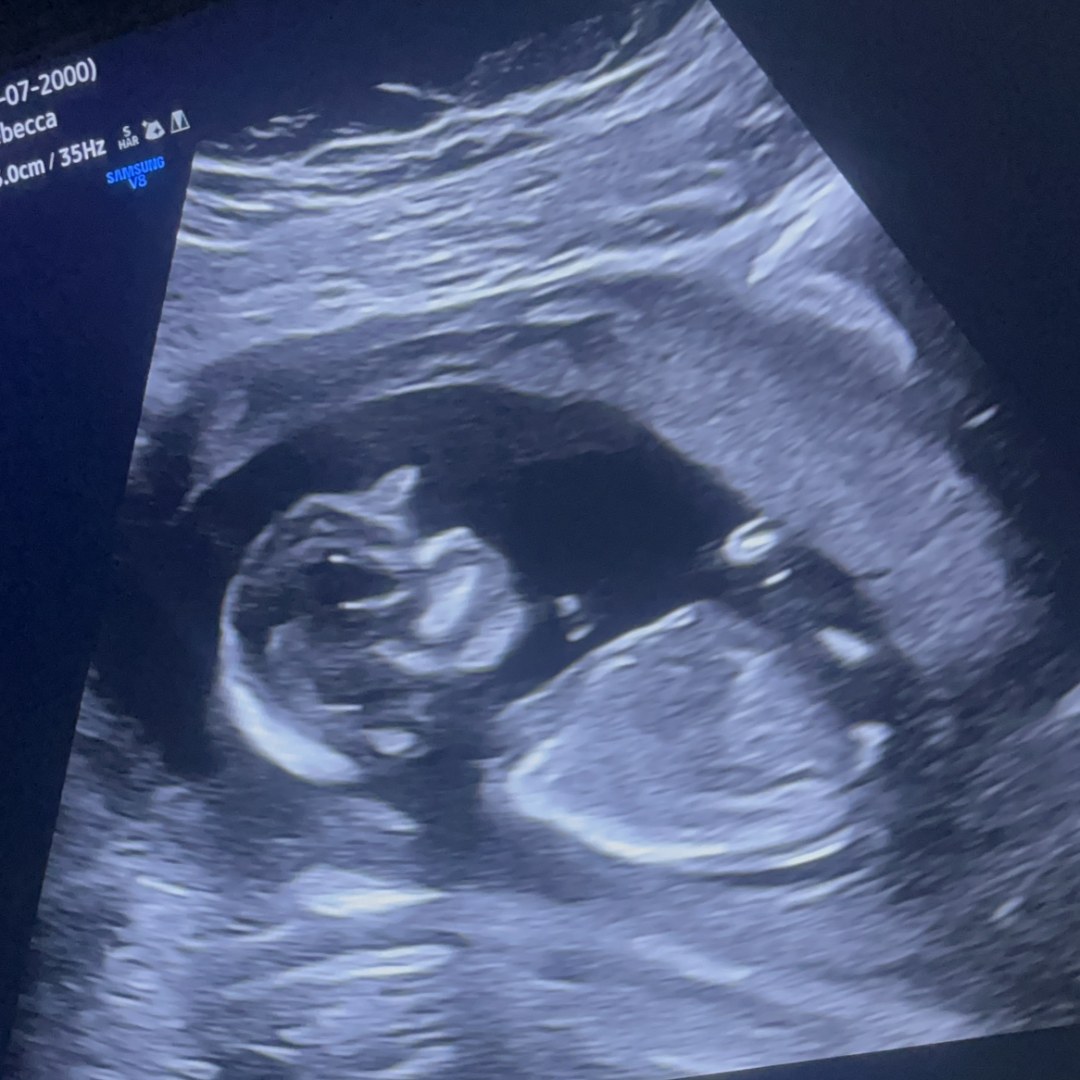 Photo shared by Rebecca for their Babylist baby registry.