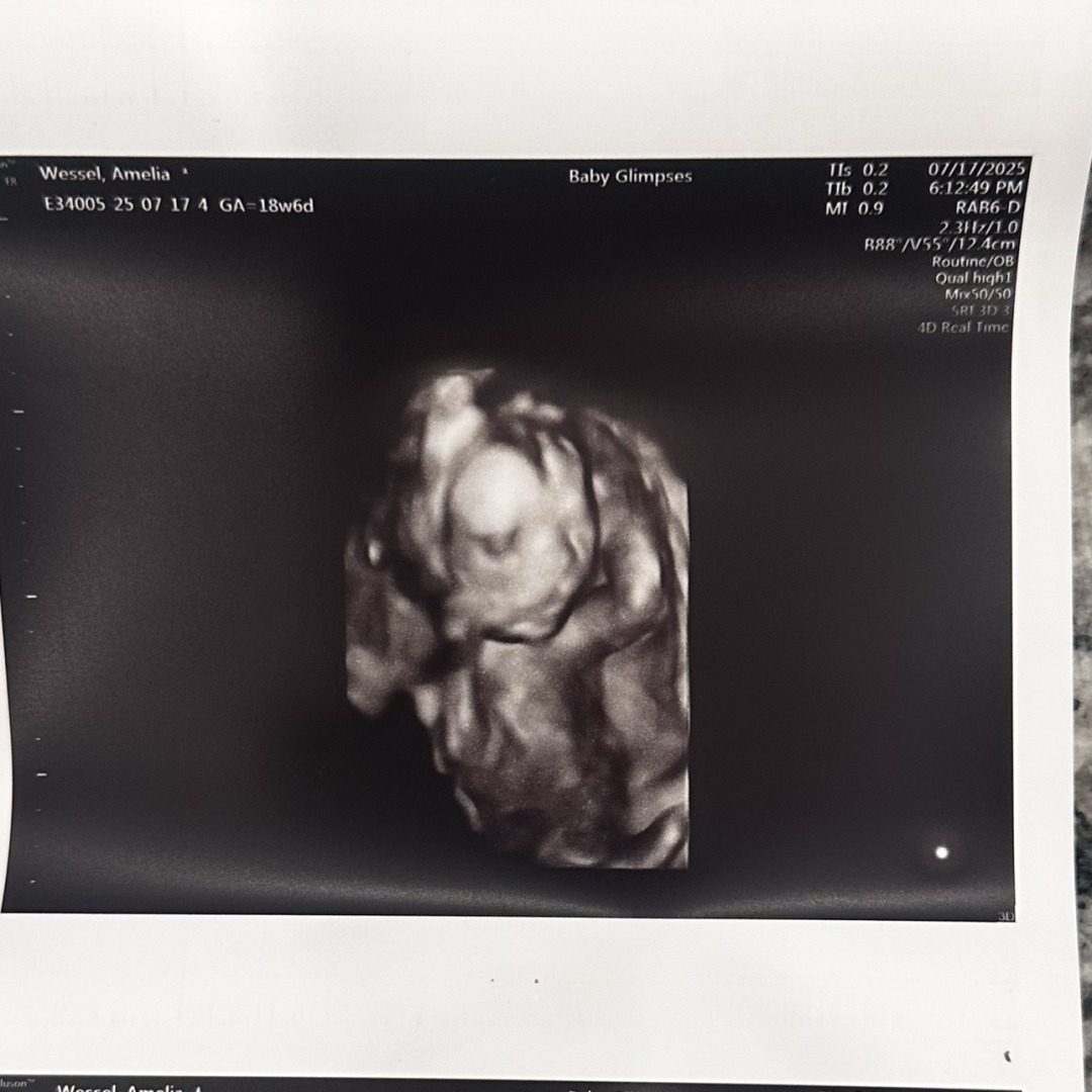 Photo shared by Amelia for their Babylist baby registry.