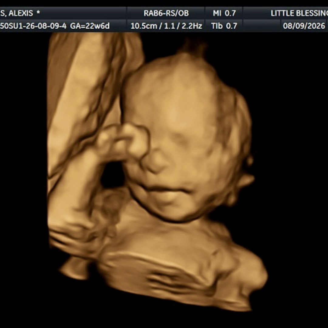 Photo shared by Alexis for their Babylist baby registry.
